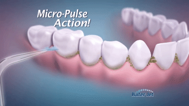 Oral Irrigator